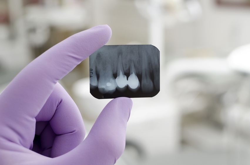 dentysta ogląda zdjęcie rentgenowskie zębów, rtg zębów